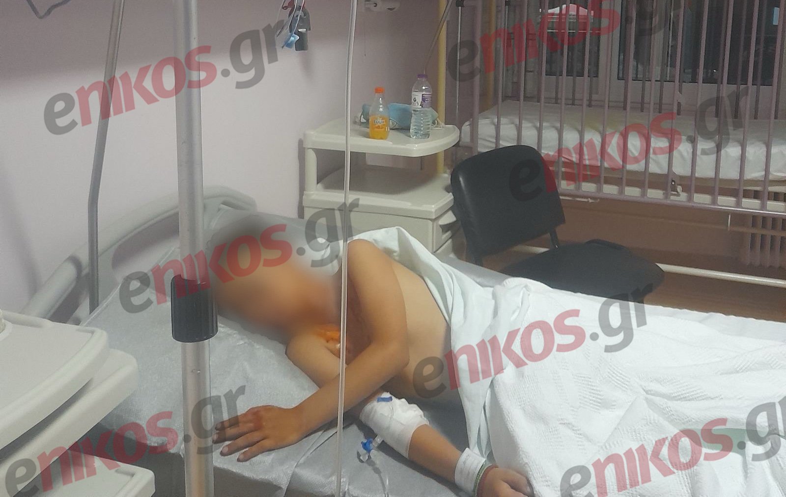 Πάτρα Βεγγαλικά Τραυματισμός