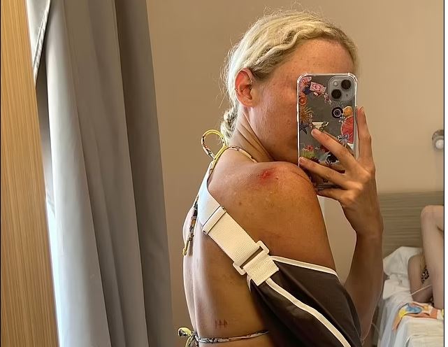 Κέρκυρα- τροχαίο