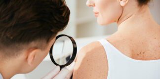 Δέρμα: Το σύμπτωμα που «προδίδει» ότι το έντερο νοσεί