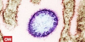 Τι είναι ο ιός Νίπα και πόσο κινδυνεύουμε; Επτά ερωτήσεις – απαντήσεις με όσα πρέπει να ξέρουμε